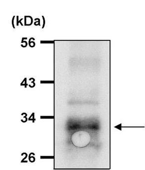 ATG5 Antibody in Immunoprecipitation (IP)