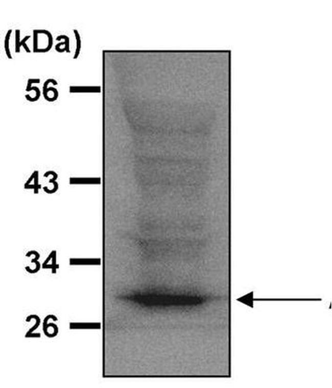 ATG5 Antibody in Western Blot (WB)