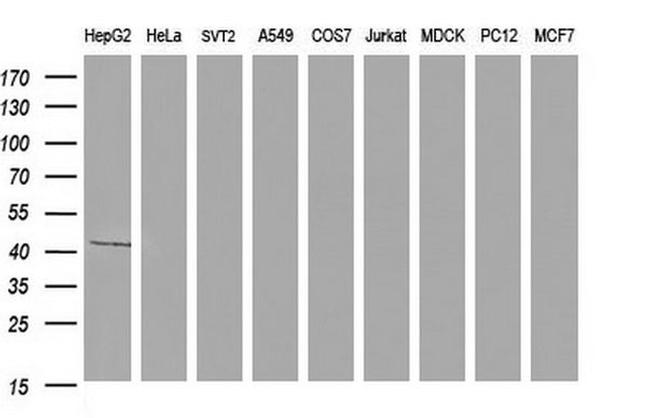 APOA5 Antibody in Western Blot (WB)