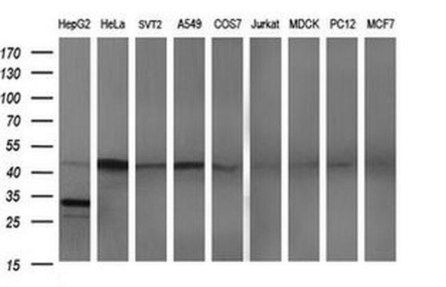 APOA5 Antibody in Western Blot (WB)