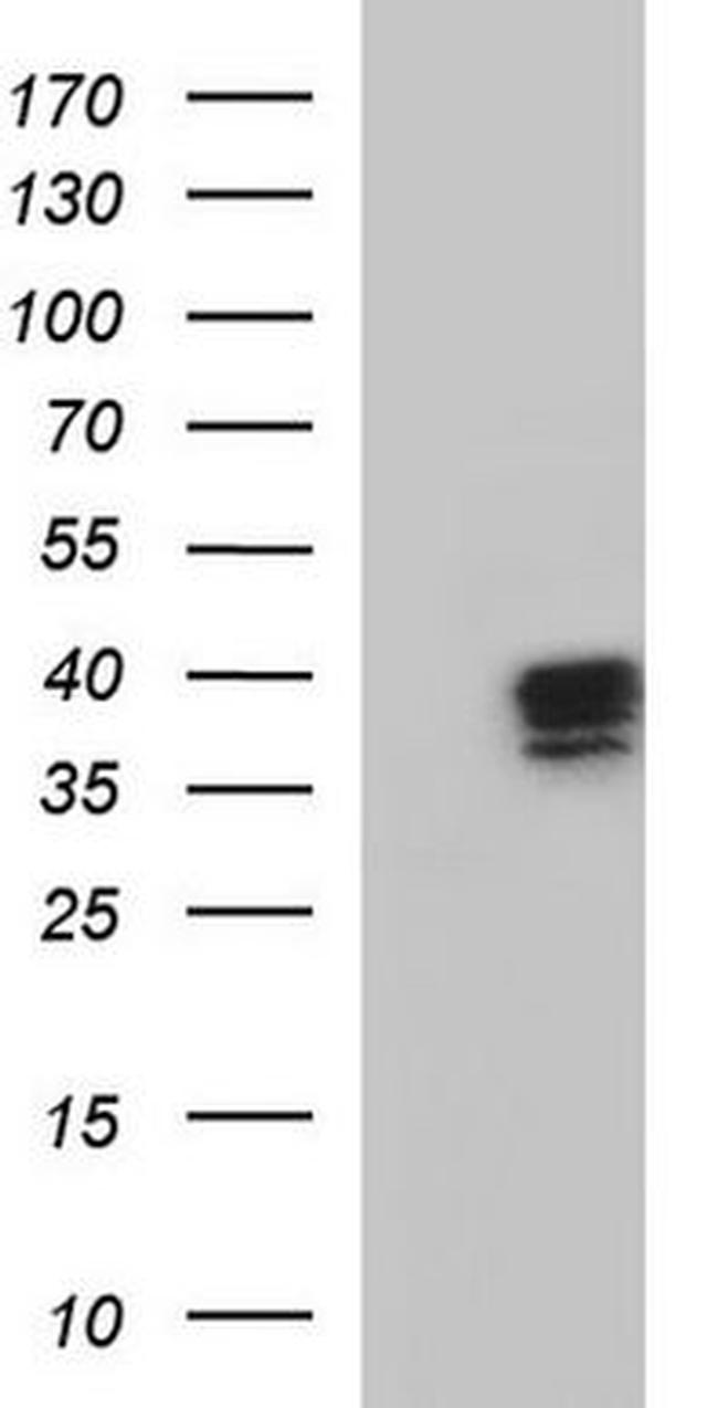 APOA5 Antibody in Western Blot (WB)