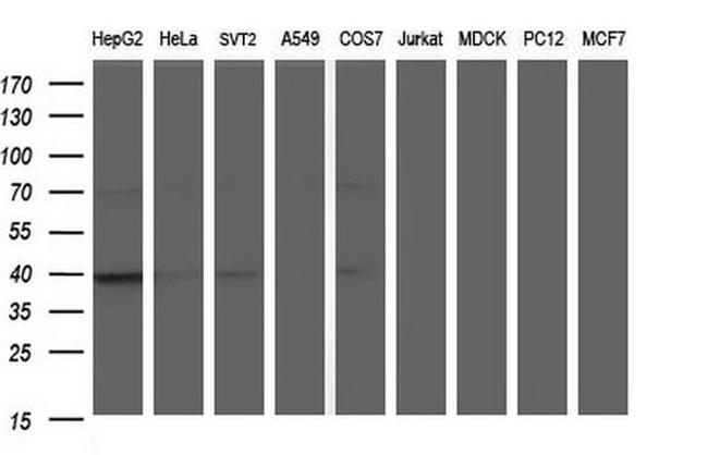 APOA5 Antibody in Western Blot (WB)