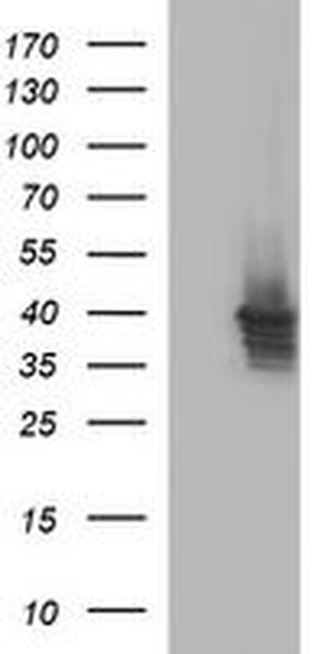 APOA5 Antibody in Western Blot (WB)