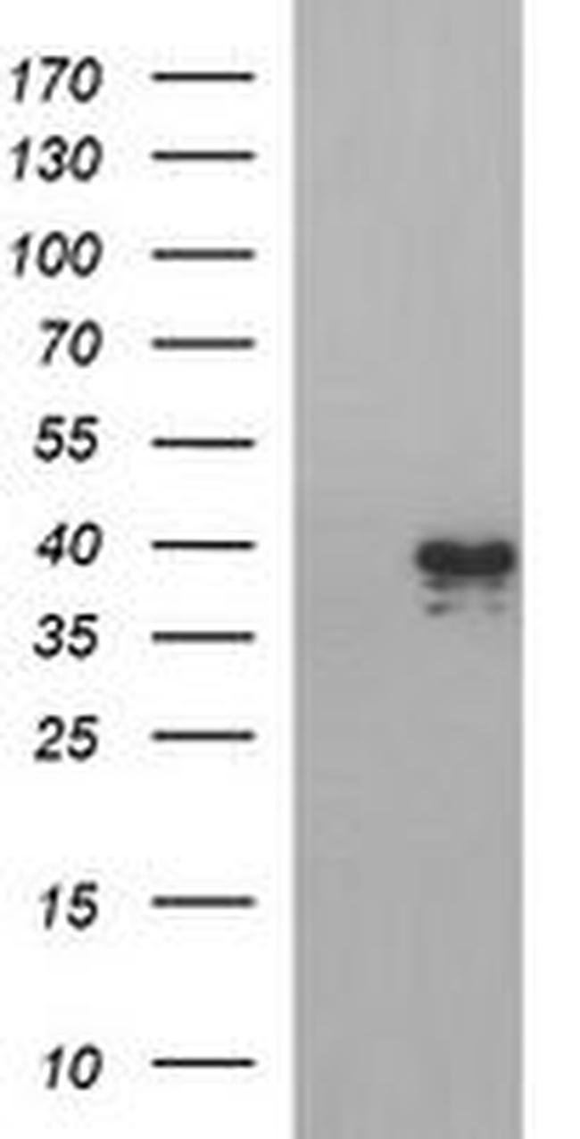 APOA5 Antibody in Western Blot (WB)