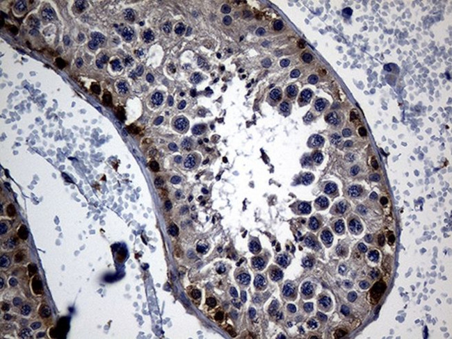 APOBEC4 Antibody in Immunohistochemistry (Paraffin) (IHC (P))