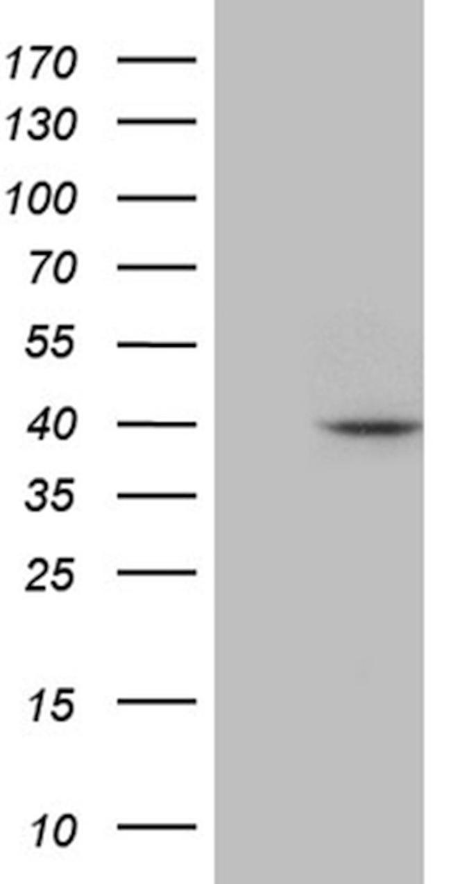 APOBEC4 Antibody in Western Blot (WB)