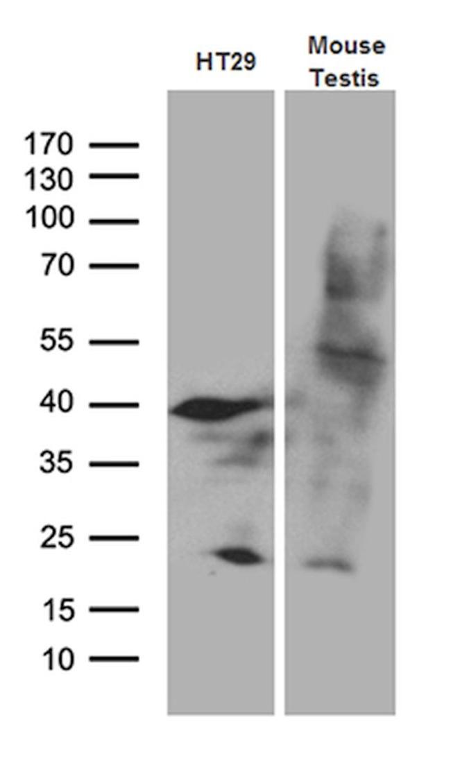 APOBEC4 Antibody in Western Blot (WB)