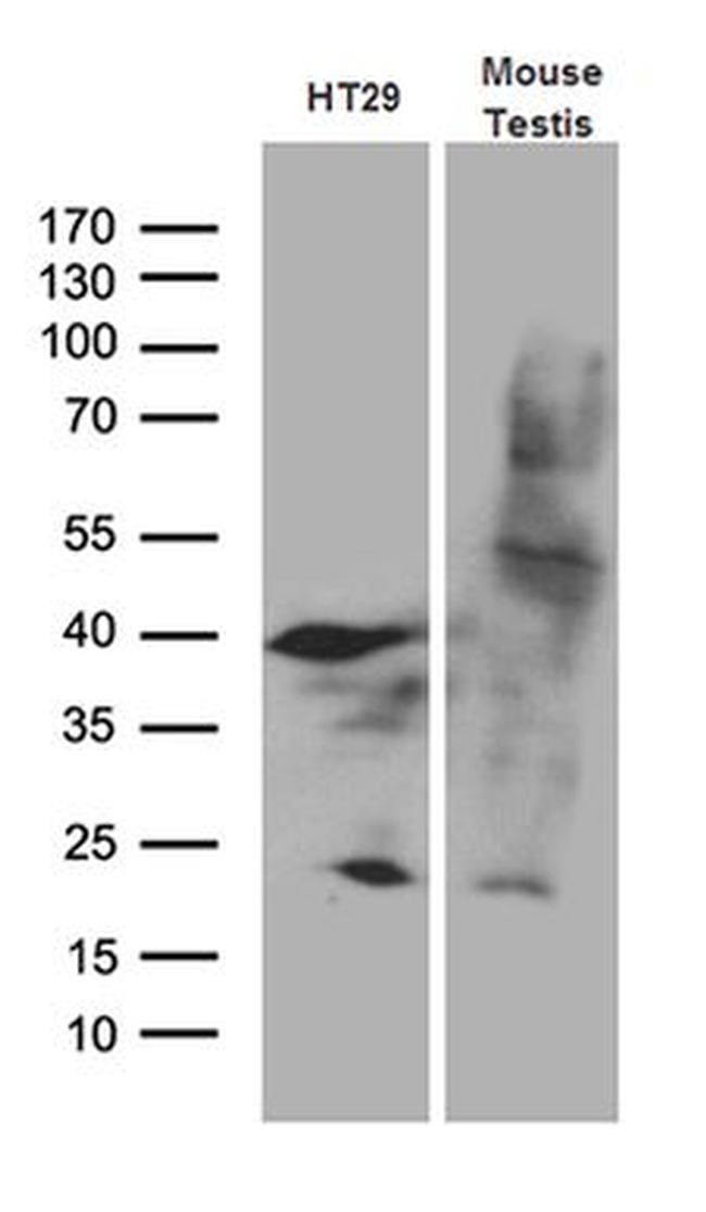 APOBEC4 Antibody in Western Blot (WB)