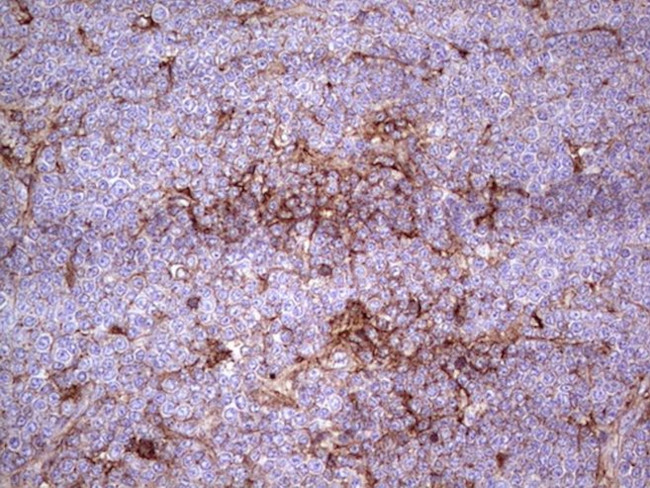 APOE Antibody in Immunohistochemistry (Paraffin) (IHC (P))