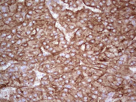 APOE Antibody in Immunohistochemistry (Paraffin) (IHC (P))