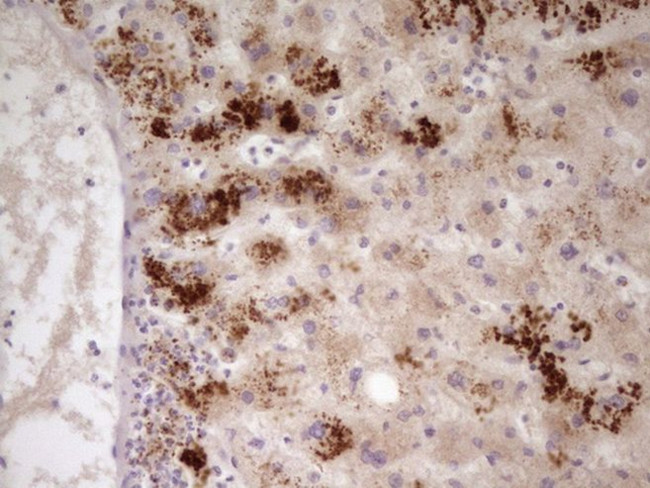 APOH Antibody in Immunohistochemistry (Paraffin) (IHC (P))