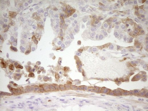 APOH Antibody in Immunohistochemistry (Paraffin) (IHC (P))