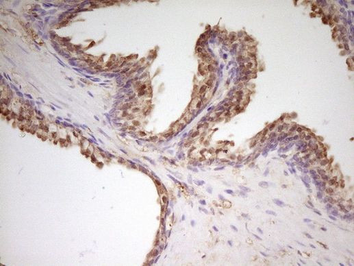 APOH Antibody in Immunohistochemistry (Paraffin) (IHC (P))