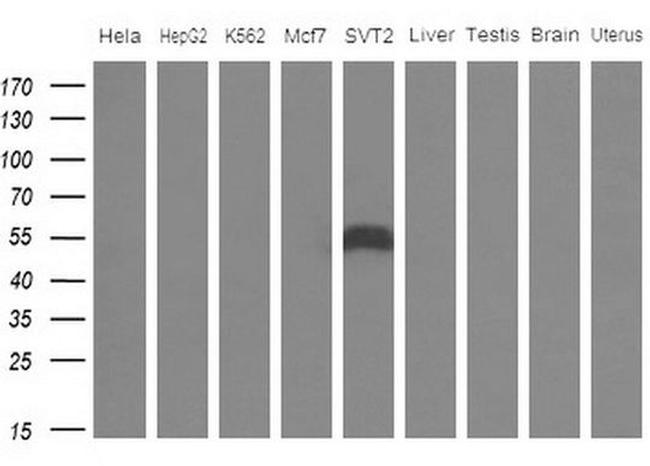 APOH Antibody in Western Blot (WB)