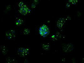 APP Antibody in Immunocytochemistry (ICC/IF)