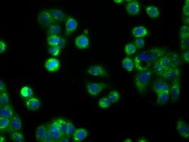 APP Antibody in Immunocytochemistry (ICC/IF)