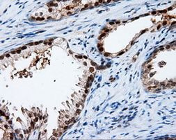 APP Antibody in Immunohistochemistry (Paraffin) (IHC (P))