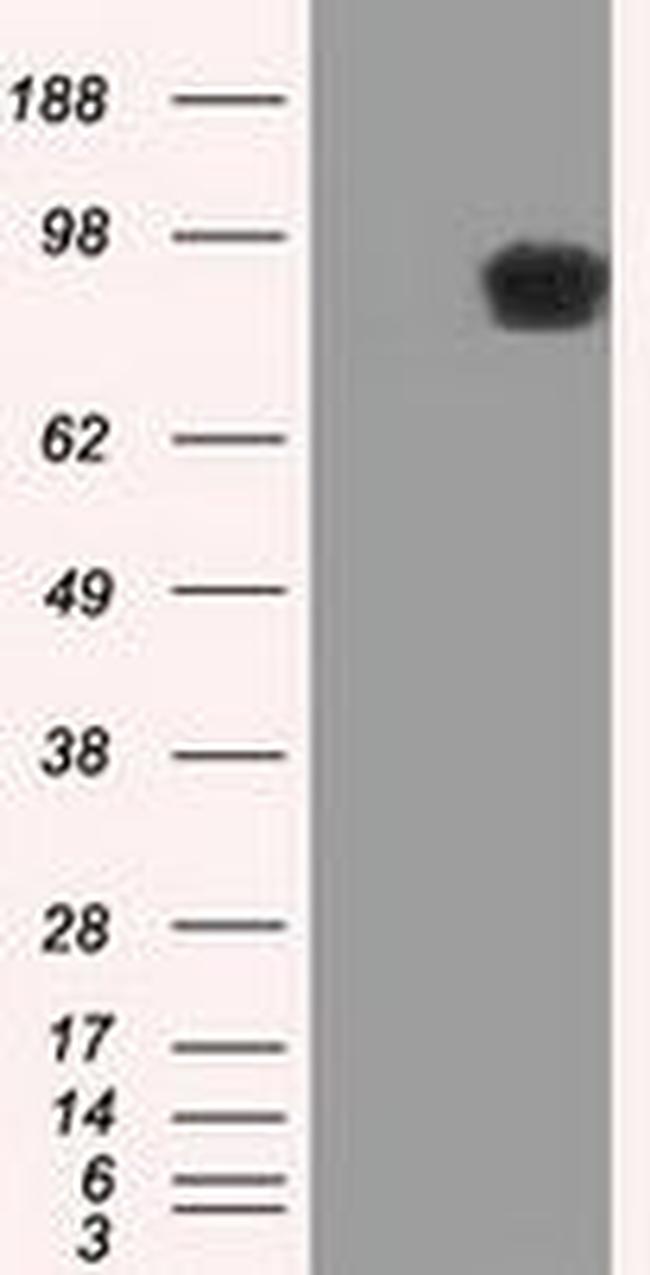 APP Antibody in Western Blot (WB)