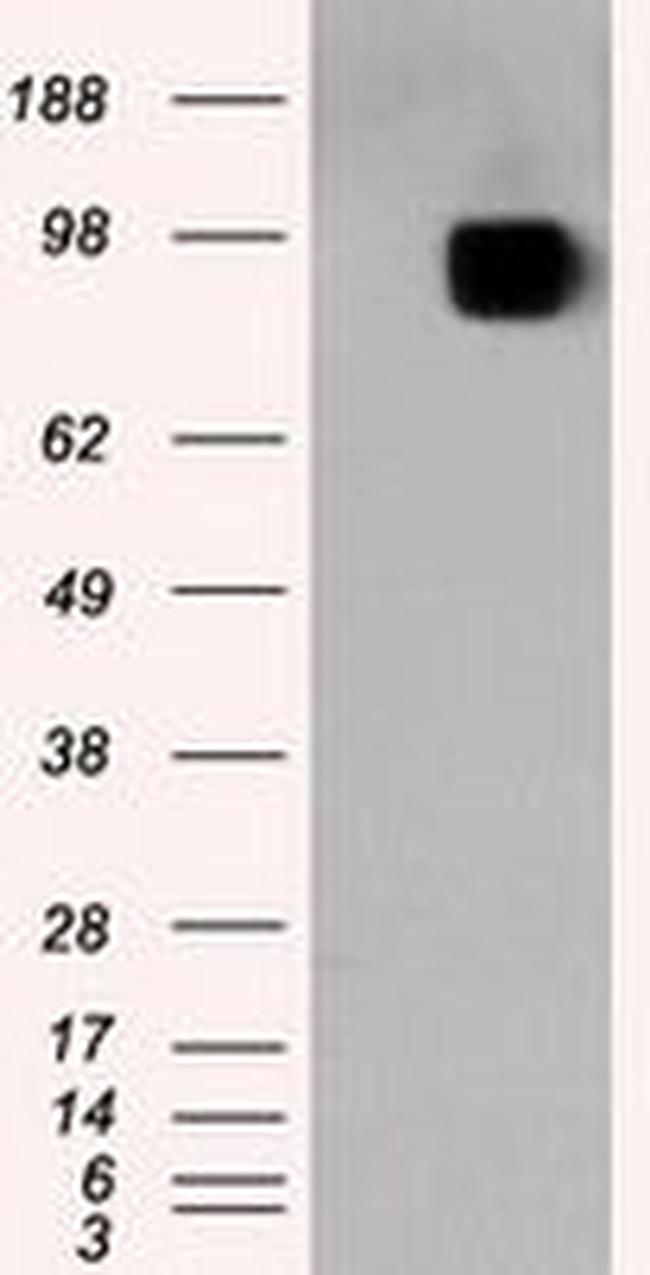 APP Antibody in Western Blot (WB)