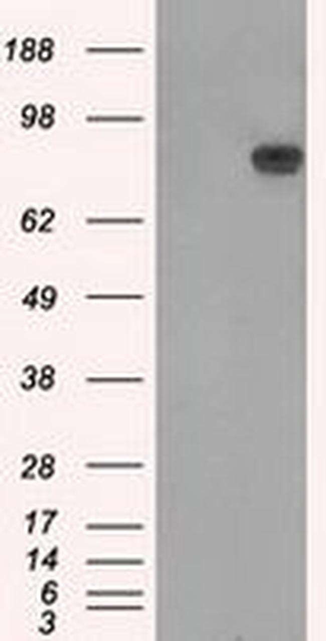 APP Antibody in Western Blot (WB)