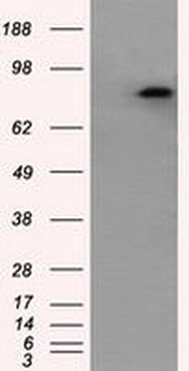 APP Antibody in Western Blot (WB)