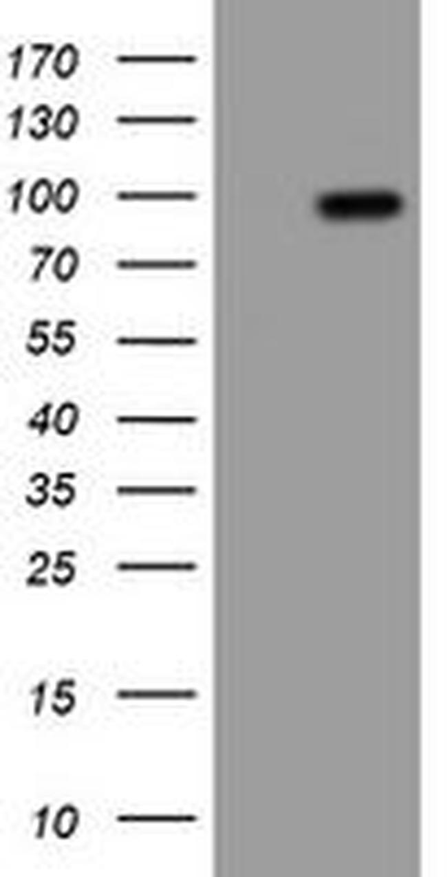 APP Antibody in Western Blot (WB)