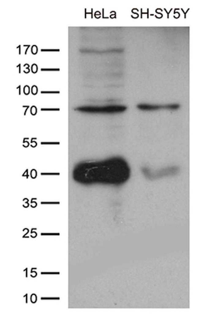 APPL2 Antibody in Western Blot (WB)