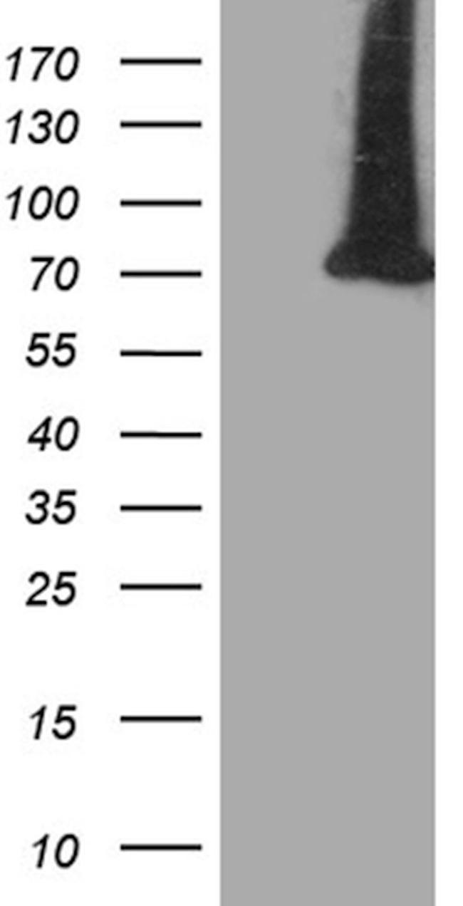 APPL2 Antibody in Western Blot (WB)