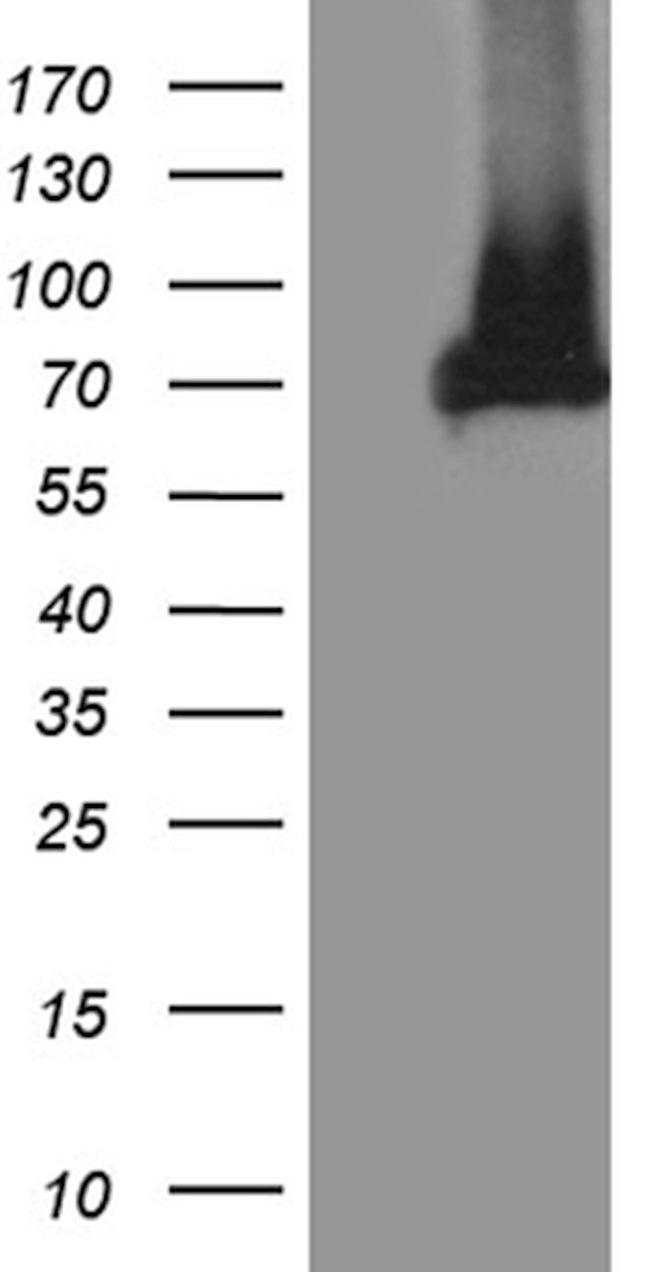 APPL2 Antibody in Western Blot (WB)