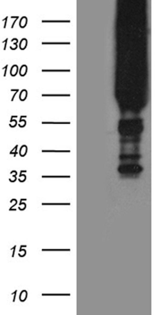 APPL2 Antibody in Western Blot (WB)