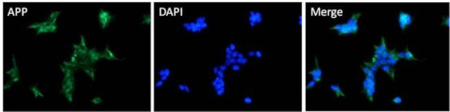 Amyloid Precursor Protein Antibody in Immunocytochemistry (ICC/IF)