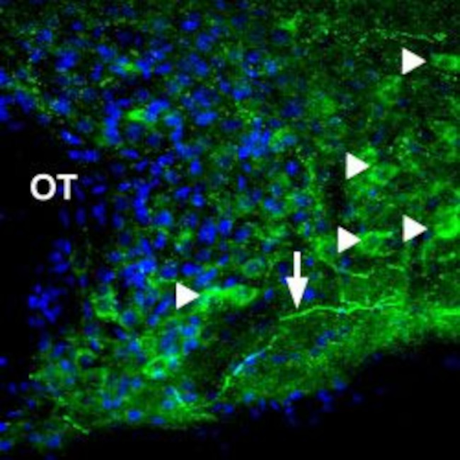 P2X1 Receptor Antibody in Immunohistochemistry (IHC)