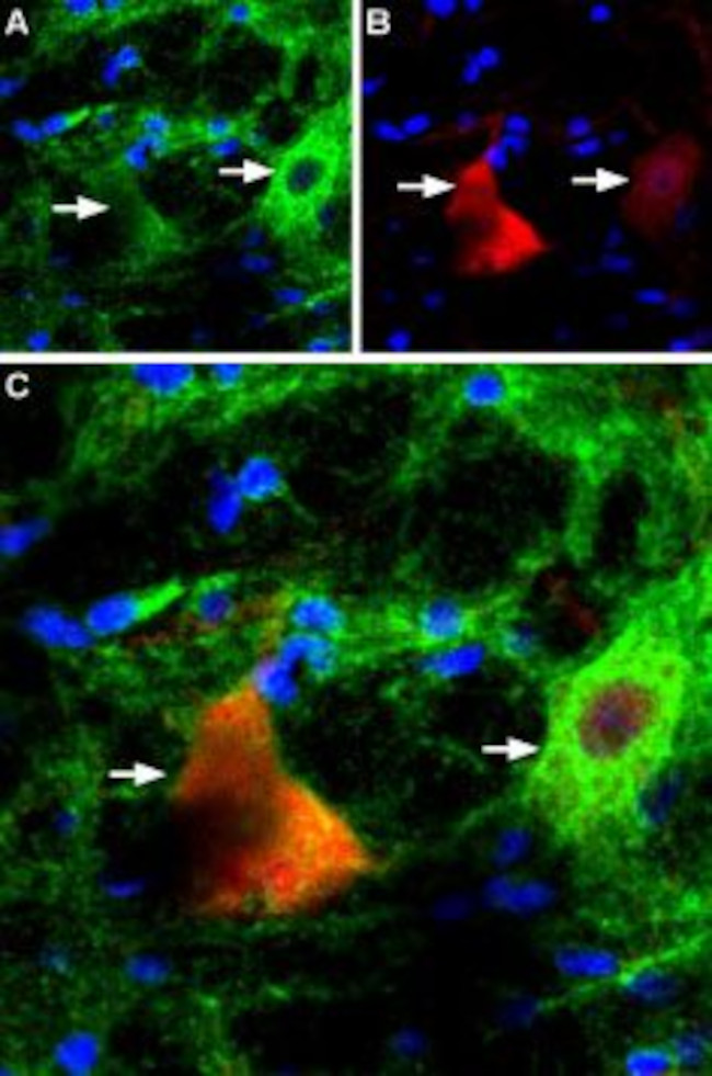 P2X4 Receptor Antibody in Immunohistochemistry (IHC)