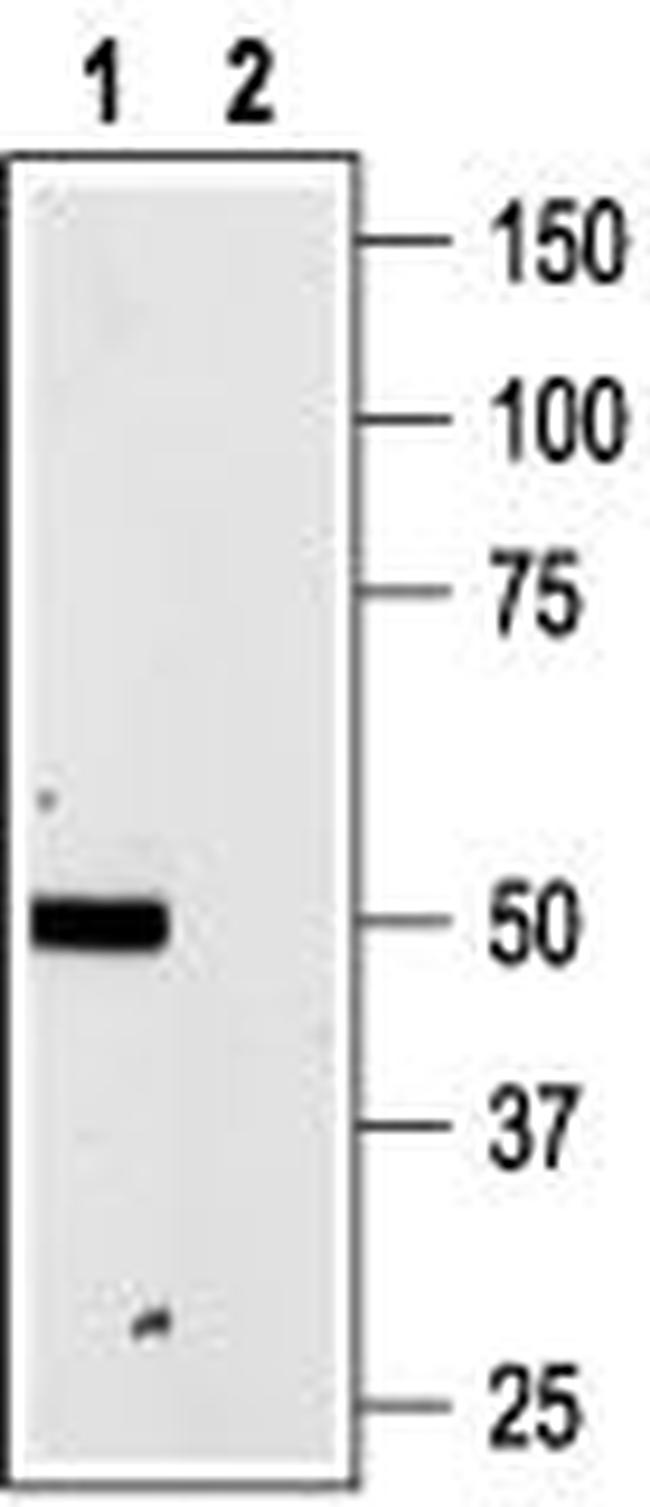 P2X4 Receptor Antibody in Western Blot (WB)