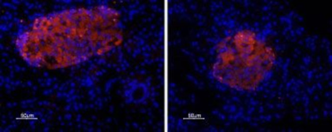 P2X7 Receptor Antibody in Immunohistochemistry (Paraffin) (IHC (P))