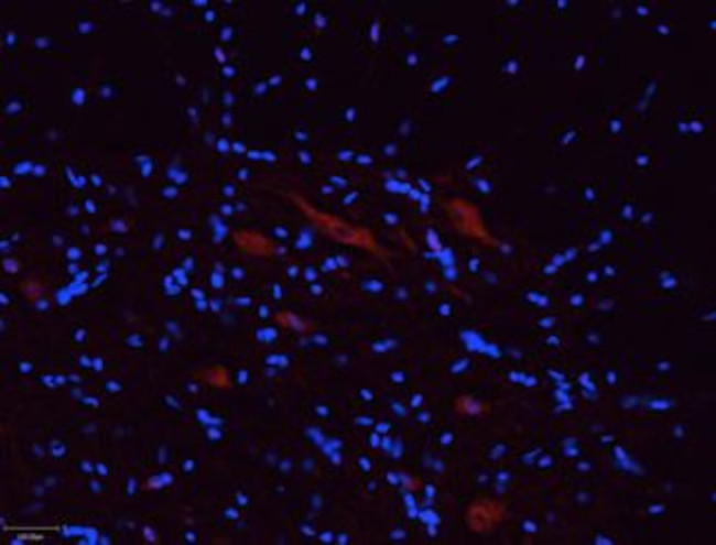 P2X5 Receptor Antibody in Immunohistochemistry (Frozen) (IHC (F))