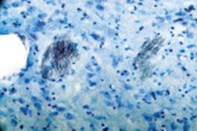 P2Y1 Receptor Antibody in Immunohistochemistry (IHC)