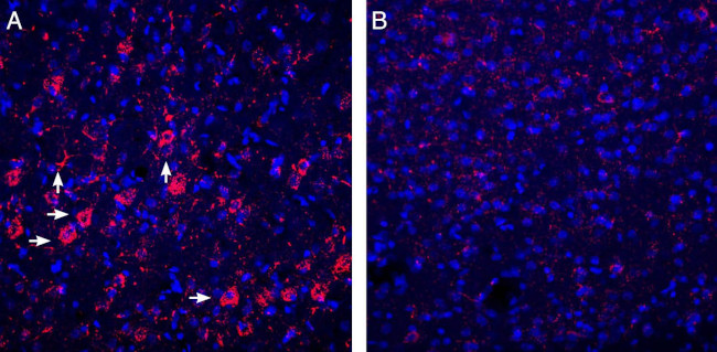 P2Y6 Receptor Antibody in Immunohistochemistry (Frozen) (IHC (F))