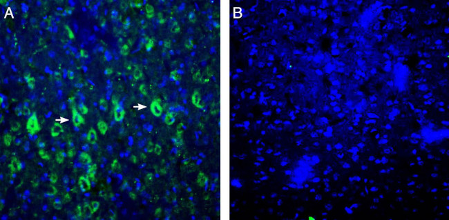 P2X6 Receptor Antibody in Immunohistochemistry (Frozen) (IHC (F))