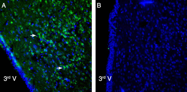 P2X6 Receptor Antibody in Immunohistochemistry (Frozen) (IHC (F))