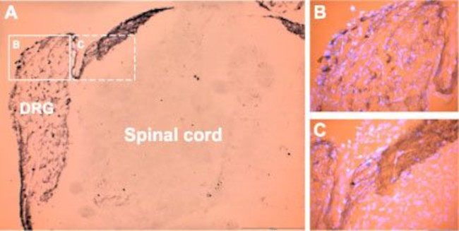 P2X3 Receptor Antibody in Immunohistochemistry (IHC)