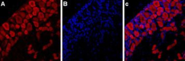 P2X3 Receptor Antibody in Immunohistochemistry (IHC)