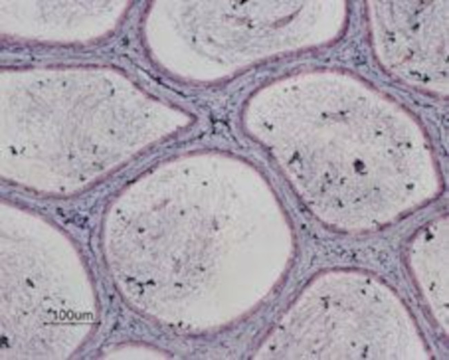 P2Y13 Receptor Antibody in Immunohistochemistry (Paraffin) (IHC (P))