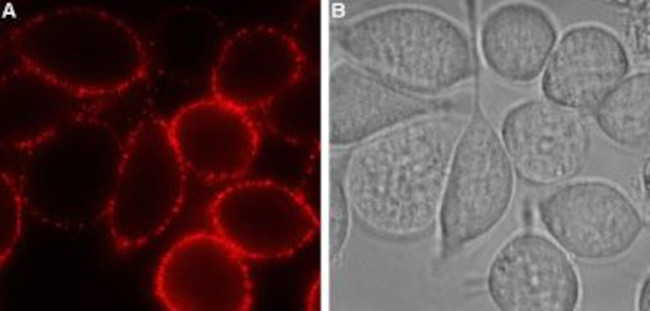 P2Y12 Receptor (extracellular) Antibody in Immunocytochemistry (ICC/IF)