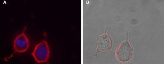 P2Y12 Receptor (extracellular) Antibody in Immunocytochemistry (ICC/IF)