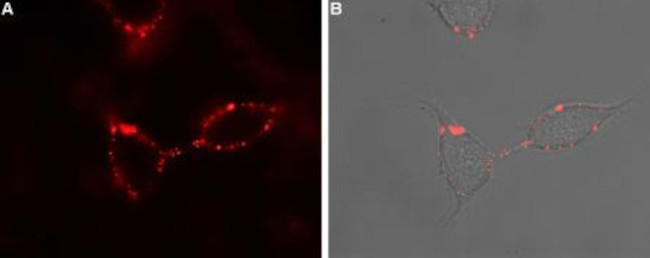 P2Y1 Receptor (extracellular) Antibody in Immunocytochemistry (ICC/IF)