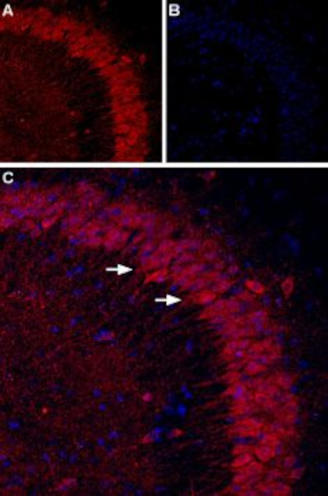 P2Y1 Receptor (extracellular) Antibody in Immunohistochemistry (IHC)