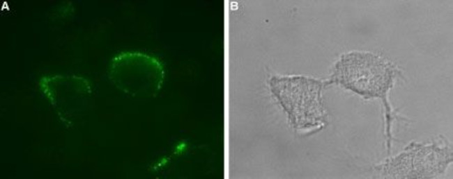 P2X1 Receptor (extracellular) Antibody in Immunocytochemistry (ICC/IF)