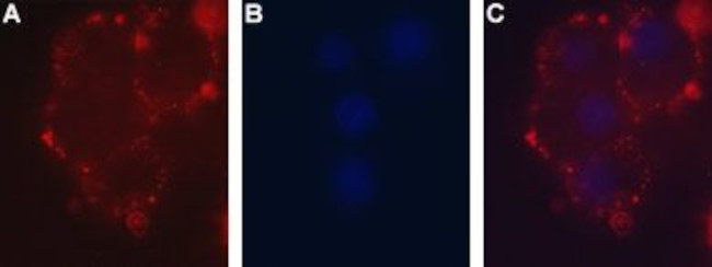 P2X2 Receptor (extracellular) Antibody in Immunocytochemistry (ICC/IF)