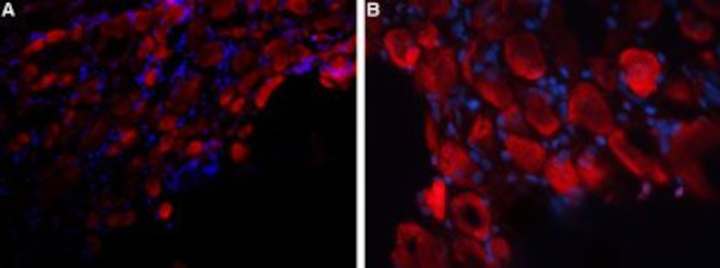 P2X3 Receptor (extracellular) Antibody in Immunohistochemistry (Frozen) (IHC (F))